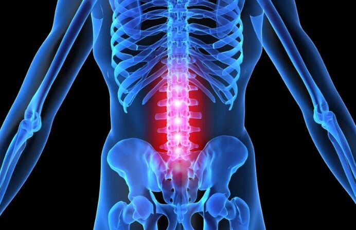 Jostas reģiona osteohondroze