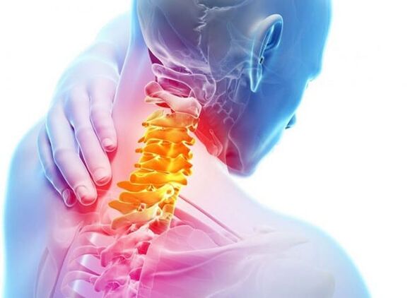 Mugurkaula kakla mugurkaula osteohondroze