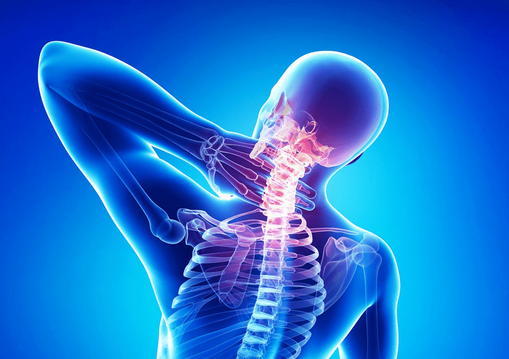 Mugurkaula osteohondroze
